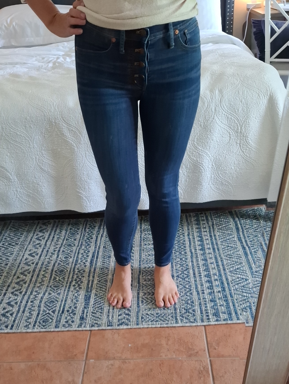 Madewell Women's Dark Blue Skinny Jeans with Button-Fly